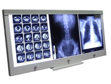 Zdjęcie Negatoskop LED NGP 31