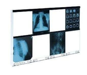Zdjęcie Negatoskop NGP-80 hf - ośmioklatkowy