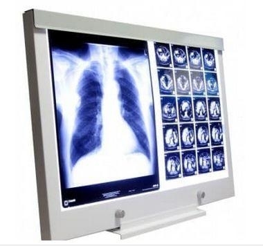 Zdjęcie Negatoskop LED NGP 21