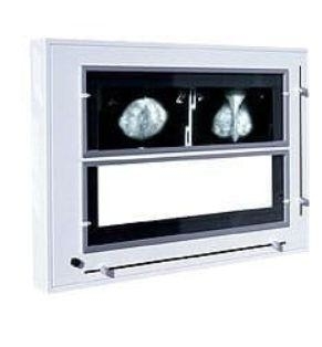 Zdjęcie Negatoskop żaluzjowy do mammografii NGP-31 mZ